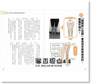 《腿型回正：改變10萬人の不痠痛直腿密技！骨科權威名醫教你》